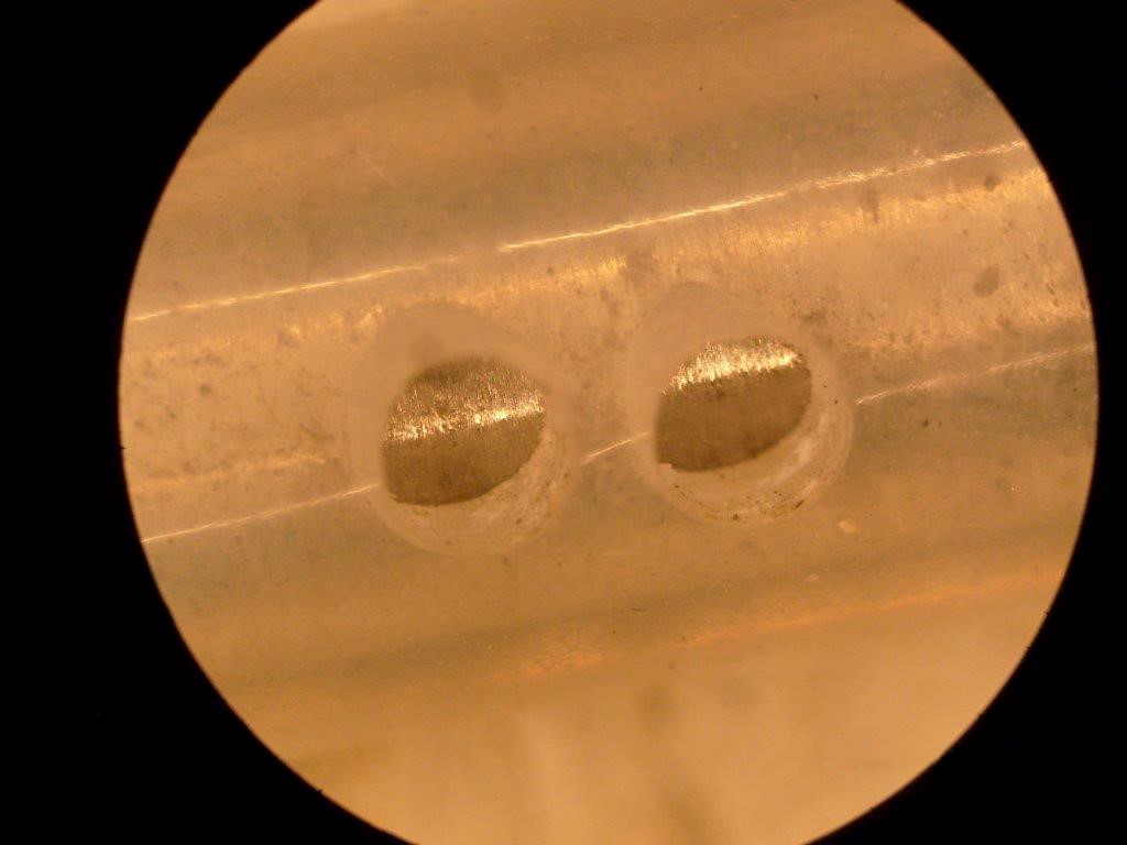 Laser ablation 1