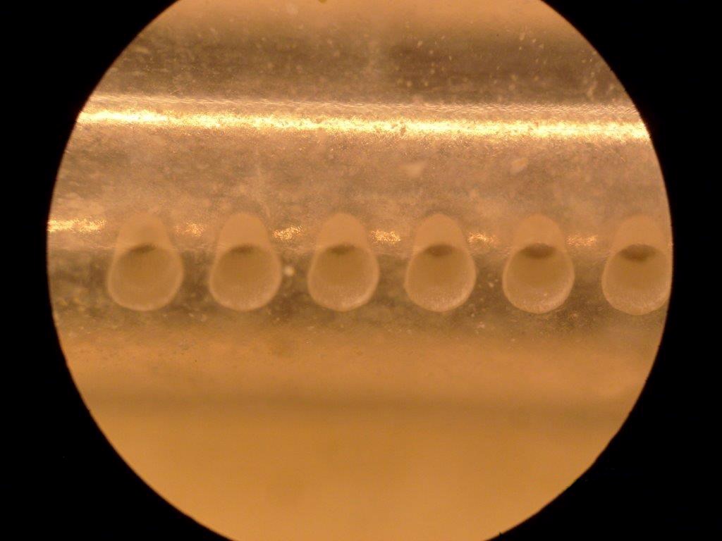Laser ablation 3